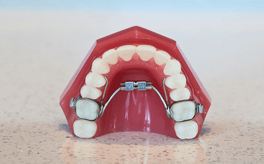 Dental Appliances